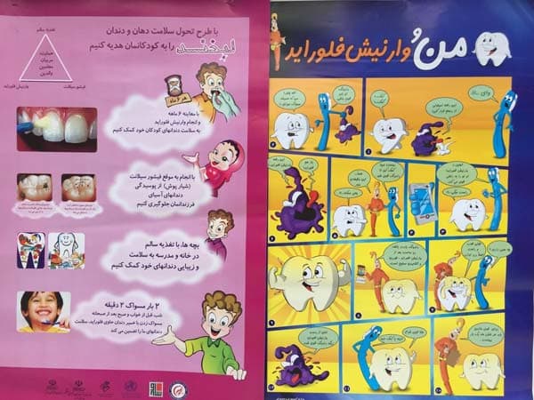 وارنیش فلوراید